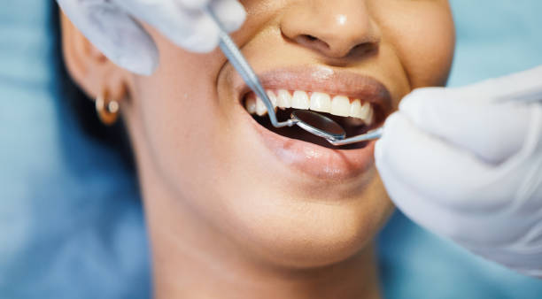 Best Emergency Dentist for Knocked-Out Tooth in Mojave, CA
