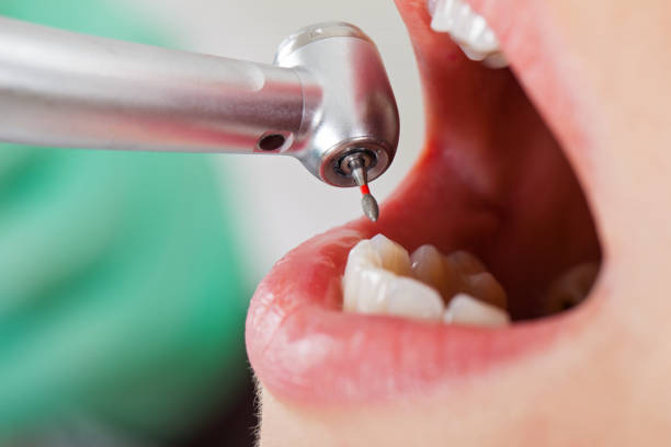 Best Pediatric Emergency Dentist in Mojave, CA